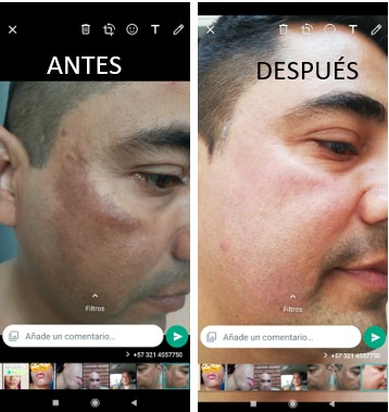 antes y despues 2png